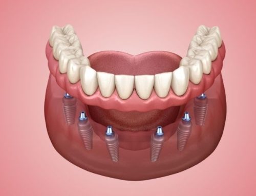 Rediscover the Power to Smile Again   Only at  – Advanced  Dentistry Center