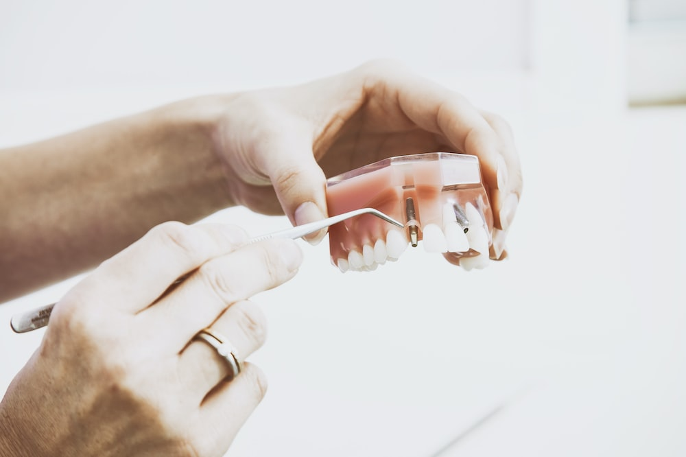 a dentist explaining dental implant insertion